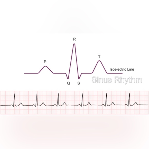 EKG ECG Electrocardio Heartbeat Heart Sinus Rhythm Med Doctor Nurse Silver Studs - Picture 4 of 11